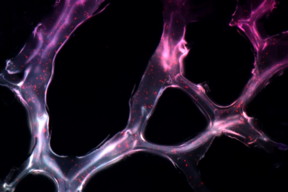 MIT researchers developed this hydrogel embedded with triple helix microRNA particles and used it to treat cancer in mice.

Image: Joo Conde, Nuria Oliva, and Natalie Artzi