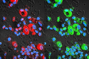 Drug-resistant lung cancer cells are in red. Paclitaxel-loaded exosomes (green) swarm the cancer cells and bypass their drug resistance.
CREDIT: UNC Eshelman School of Pharmacy