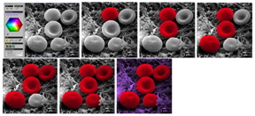 Each stage of the colorization process of an image of erythrocytes (red blood cells) using Mountains 7.3 is shown above. Only one mouse click is necessary to pass from one step to another, whereas previously the same operation would have taken hours using photo editing software.