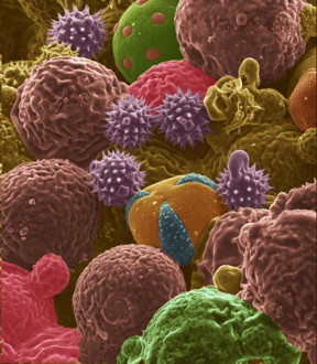 This scanning electron microscope image shows bee pollen studied for potential use as electrodes for lithium-ion batteries. Color was added to the original black-and-white image. 
CREDIT:Purdue University image/ Jialiang Tang