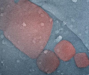 This is a false-color scanning electron microscope image of real cubosomes.
CREDIT: L. Latypova, P. Pieraski; Laboratoire de Physique des Solides, Universit Paris-Sud, Orsay Cedex, France