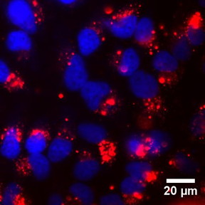 Image shows HeLa cells incubated for 24 hours with serum-coated TiO2 nanoparticles (proteins are tagged with a red fluorophore). Cell nuclei are stained with DAPI (blue).

Credit: Georgia Tech
