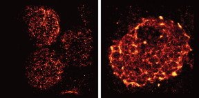 Salk scientists used light-sheet super-resolution imaging to capture the rearrangement of T-cell receptors from nanometer-scale protein islands (left) to micrometer-scale microclusters (right) after T-cell activation in mouse lymph nodes.
CREDIT: Salk Institute