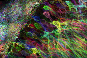 MIT researchers have developed a new way to image proteins and RNA inside neurons of intact brain tissue.

Image: Yosuke Bando, Fei Chen, Dawen Cai, Ed Boyden, and Young Gyu