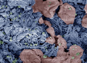 Nanoparticles (green) help form clots in an injured liver. The researchers added color to the scanning electron microscopy image after it was taken.
CREDIT: Erin Lavik, Ph.D.