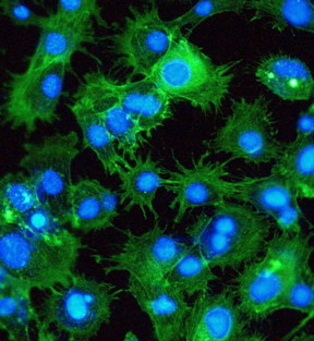 Fluorescent images of breast carcinoma cell line showing the morphological changes of cells grown on vertical GAIN scaffolds.
CREDIT: Aalto University / Michael Gasik