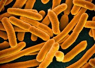 Catching E. coli contamination in foods requires a fast sensor.
Credit: National Institute of Allergy and Infectious Diseases, National Institutes of Health