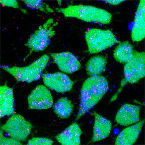 Image of cancer cells (green) taking up fluorescently labeled nanoparticles (red), demonstrating the possibility of more efficient delivery of traditional cancer drugs. Image by Eric Song