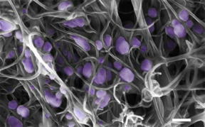 Scanning electron microscope image (scale bar, 200 nm) of the H5N2 avian influenza virus (purple) trapped inside the aligned carbon nanotube.
CREDIT: Penn State University