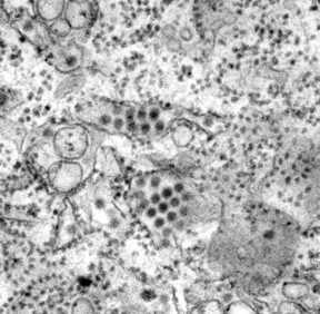 This transmission electron micrograph (TEM) depicts a number of round, Dengue virus particles that were revealed in this tissue specimen.
CREDIT
CDC/ Frederick Murphy
