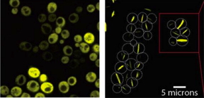 Yeast cells producing a bacterial symmetric protein complex with eight units. When it is not mutated (left), the complex diffuses freely inside the cell, but a single mutation (right) triggers its assembly into long filaments.
CREDIT
Weizmann Institute of Science