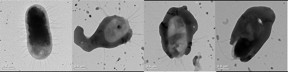 Macromolecular shielding of microorganisms using polymer conjugated antibodies. These pictures show transmission electron microscopy images of bare (left) and fully shielded (right) bacteria.