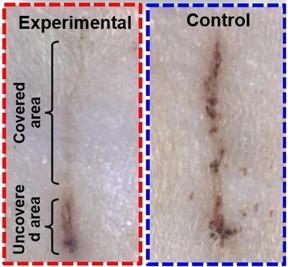 A wound covered by an electric bandage on a rat's skin (top left) healed faster than a wound under a control bandage (right).

CREDIT
American Chemical Society