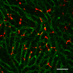After intravenous injection into mice, STING-lipid nanoparticles (red) transported through blood vessels(green) accumulate in the liver (Takashi Nakamura, et al. Journal for ImmunoTherapy of Cancer. July 2, 2021).

CREDIT
Takashi Nakamura, et al. Journal for ImmunoTherapy of Cancer. July 2, 2021.