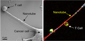 Left: Field emission scanning electron microscopy (FESEM) image shows the formation of a nanotube between a breast cancer cell and an immune cell. Right: Confocal microscopy image shows mitochondria (labeled with green fluorescence dye) traveling from a T cell to a cancer cell through the intercellular nanotube. DNA in the mitochondria was labeled with blue dye.

CREDIT
Nature Nanotechnology https://doi.org/10.1038/s41565-021-01000-4