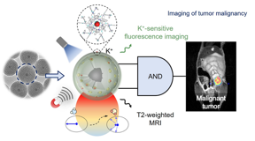 A K+ sensitive dual-mode nanoprobe with superior magnetic resonance contrast effect and K+-specific fluorescence imaging performance is developed for non-invasive tumor imaging and malignancy identification via a cascaded ‘AND’ logic operation.
CREDIT
©Science China Press