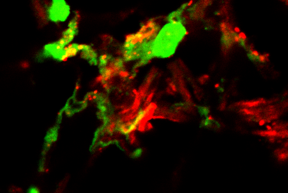 Confocal microscopy image shows that DNA (green) and the chemokine CXCL4 (red) colocalize (indicated by yellow areas) during inflammatory responses in the skin.
CREDIT
Barrat lab
