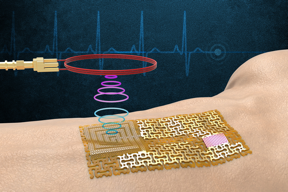 MIT engineers fabricated a chip-free, wireless electronic “skin.” The device senses and wirelessly transmits signals related to pulse, sweat, and ultraviolet exposure, without bulky chips or batteries.
CREDIT
Courtesy of the researchers