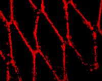 Magnetic nanoparticles loaded into endothelial cells show a red fluorescent glow on the struts of a steel stent.

Credit: The Children's Hospital of Philadelphia
