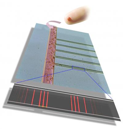 An optical micrograph of the chip itself, showing the region on the chip from which the plasma is separated from the whole blood. Whole blood cells can be seen traveling down the wider channel. The thinner channels are the plasma skimming channels. Channel dimensions: large channel ~50 micrometer wide; skimming channels ~10 micrometers wide. The barcode at the bottom of the drawing represents a panel of about 10 proteins that were measured from a fingerprick of blood within the 10 minute time from from fingerprick to completion of the critical assay steps. This particular chip, which was about the size of a microscope slide, contained regions for 8 separate fingerprick assays.

Credit: Courtesy R. Fan & J. Heath