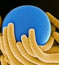 Bristles hugging a polystyrene sphere.

Credit: Courtesy of Aizenberg lab at the Harvard School of Engineering and Applied Sciences