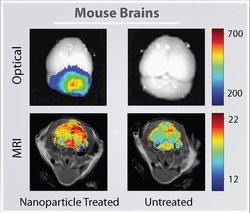A mouse brain tumor imaged using nanoparticles (left column) or conventional techniques (right column) combined with optical imaging and MRI. The nanoparticles give a clearer picture of the tumor, which is located at the back of the brian in the cerebellum.  Image courtesy University of Washington.  
