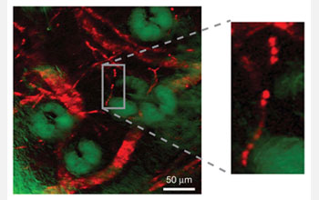 Stimulated emission image of the microvascular network in a mouse's ear. The sample shows in red the blood vessel network surrounding green-colored sebaceous glands. Sebaceous glands are microscopic glands located in skin that secrete an oily and waxy matter used to lubricate the skin and hair of animals. A technique called confocal reflectance was simultaneously used to record the green-colored sebaceous glands. The image is based on contrasts of non-fluorescent hemoglobin molecules.

In the zoomed-in image, individual red blood cells are lined up within a single capillary approximately five micrometers in diameter. A micrometer is one-millionth of a meter.

The structure and hemoglobin-dynamics of blood vessels play a major role in many biomedical processes, such as angiogenesis in tumors and cerebral oxygen delivery in the brain. Angiogenesis is the growth of new blood vessels from pre-existing vessels. It is also a fundamental step in the transition of tumors from a dormant to malignant state.

Credit: X. Sunney Xie, Department of Chemistry and Chemical Biology, Harvard University