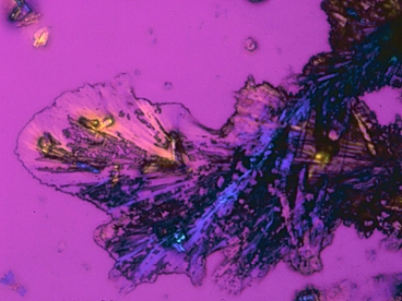 Crystals of cisplatin, a platinum compound that is used as a chemotherapy drug, are shown here. Image: National Cancer Institute 