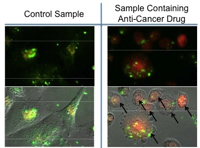 Images of nanoparticles (green) taken up by breast cancer cells. In the control sample (left), the magnetic field is not turned on. For the sample exposed to the magnetic field (right), an anticancer drug doxorubicin (red) is released into the cells, and the cells are killed.