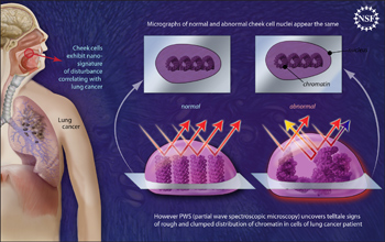 Nano-scale disturbances in cheek cells indicate the presence of lung cancer.