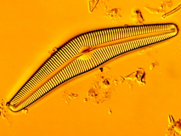 An image of a species of diatom, Cymbela cistula. Markus Buehler says diatoms are a good example of the way weak building blocks  in this case, fragile and brittle silica  can be used in biology to build strong and durable materials, by assembling them in structures organized differently at different scales. Image: NSF