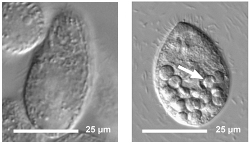 The quantum dot-tainted bacteria stop digestion in the protozoan, and food vacuoles with undigested material accumulate, seen in the right image. This is in contrast to the normal condition of protozoa eating untreated bacteria, seen in the left image.