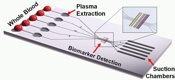 Schematic of the tether-free SIMBAS chip that shows some of the functional elements, such as the blood loading area, the plasma separation microtrenches, detection sites and the suction flow structures.  (Ivan Dimov image)