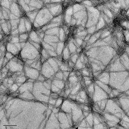Amyloid fibrils like those magnified here 12,000 times are thought to be the cause of plaques in the brains of Alzheimer's disease patients. Rice University researchers have created a metallic molecule that becomes strongly photoluminescent when it attaches to fibrils.
(Credit: Nathan Cook/Rice University)