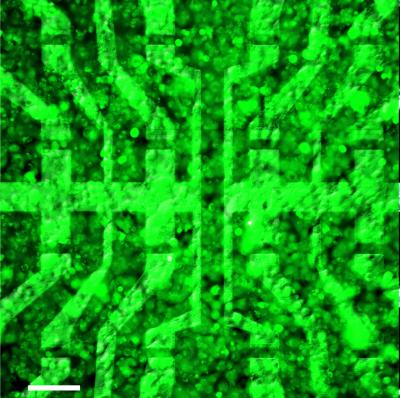 This combination of optical microscopy and fluorescence imaging shows a layer of biological cells covering a graphene-based transistor array. The experimental device, created by scientists from the Technische Universitaet Muenchen and the Juelich Research Center, is the first of its kind to prove capable of recording signals generated by living cells, with good spatial and temporal resolution. With this demonstration, the researchers have opened the way to further investigation of the feasibility of using graphene-based bioelectronics for potential future applications such as neuroprosthetic implants in the brain, the eye, or the ear.

Credit: Copyright TU Muenchen