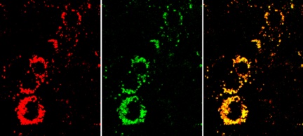    The yellow nanosensor signal in the overlay image (right) shows that the cells are active. If they were unhealthy, they would appear much redder. Center: the indicator dye signal. Left: the reference dye signal.  Fraunhofer EMFT