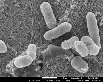 A scanning electron  microscope image of E. coli O157:H7 bacteria captured on the surface of a biosensor chip. Photo courtesy of Evangelyn Alocilja laboratory
