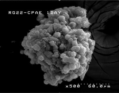 The 3-D glioma model, developed at Brown University, allows the glioma and the supporting endothelial cells to assemble naturally, just as they would in real life.

Credit: Shouheng Sun Lab, Brown University