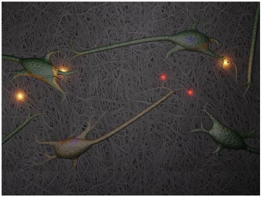 Nerve cells growing on a three-dimensional nanocellulose scaffold. One of the applications the research group would like to study is destruction of synapses between nerve cells, which is one of the earliest signs of Alzheimers disease. Synapses are the connections between nerve cells. In the image, the functioning synapses are yellow and the red spots show where synapses have been destroyed.
 Illustration: Philip Krantz