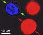 Identical cells stained red and blue were the target of research at Rice University to show the effect of plasmonic nanobubbles. The bubbles form around heated gold nanoparticles that target particular cells, like cancer cells. When the particles are hollow, bubbles form that are large enough to kill the cell when they burst. When the particles are solid, the bubbles are smaller and can punch a temporary hole in a cell wall, allowing drugs or other material to flow in. Both effects can be achieved simultaneously with a single laser pulse. (Credit: Plasmonic Nanobubble Lab/Rice University)