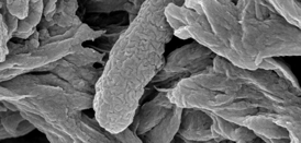 A dead E. coli bacterium collected in a filter after treatment with the Stanford nanoscavenger.Image: Mingliang Zhang, Stanford School of Engineering.