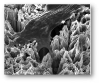 This is a bone cell anchoring itself to a surface of titanium dioxide nanotubes. Because osteoblasts readily adhere to this novel surface, dental implants coated with TiO2 nanotubes could significantly improve healing following dental implant surgery.

Credit: Tolou Shokuhfar