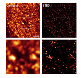 Immunostained nuclear pore complexes in HeLa cells (NUP153-ATTO 647N) illustrate the resolution enhancement achieved with Leica TCS SP8 STED 3X and the 775 nm pulsed STED laser (right images) compared to the resolution achieved with confocal microscopy (left images). 