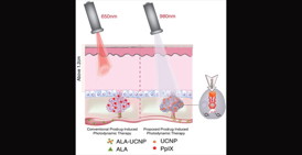 Research by Gang Han, PhD, shows that upconversion nanoparticles that can convert near-infrared light into red light can be used to extend photodynamic therapy for some cancers found in deeper tissues.