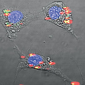 Image: Prabhas Moghe, et. al.
Rare-earth nanoparticles encapsulated in albumin shells glow under infrared light.