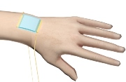 A new kind of stretchy "electronic skin" (blue patch) is the first to be able to detect directional pressure.
Credit: American Chemical Society