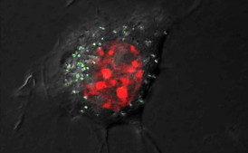 This is a microscope image of a cell with silver nanoparticles with green fluorescence and red-stained nucleus.
CREDIT: MPIKG