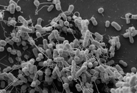 This is an electron micrograph of genetically modified Acinetobacter baylyi and Escherichia coli strains. The bacteria exchange amino acids via nanotubes (i.e. tube-like connections between cells).
CREDIT: Martin Westermann, Electron Microscopy Center, University Hospital, Friedrich Schiller University Jena, Germany