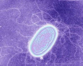 UMass Amherst scientists say they have settled the dispute between theoretical and experimental scientists by devising a combination of new experiments and better theoretical modeling of specialized electrical pili in the bacterium Geobacter.
CREDIT: Derek Lovley and Eric Martz