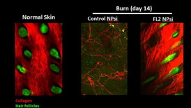 Imaging of burns indicates that those treated with the FL2 inhibitor nanotechnology experienced collagen deposition and hair follicle formation. (2-photo confocal microscopy).
CREDIT: Vera DesMarais/Albert Einstein College of Medicine